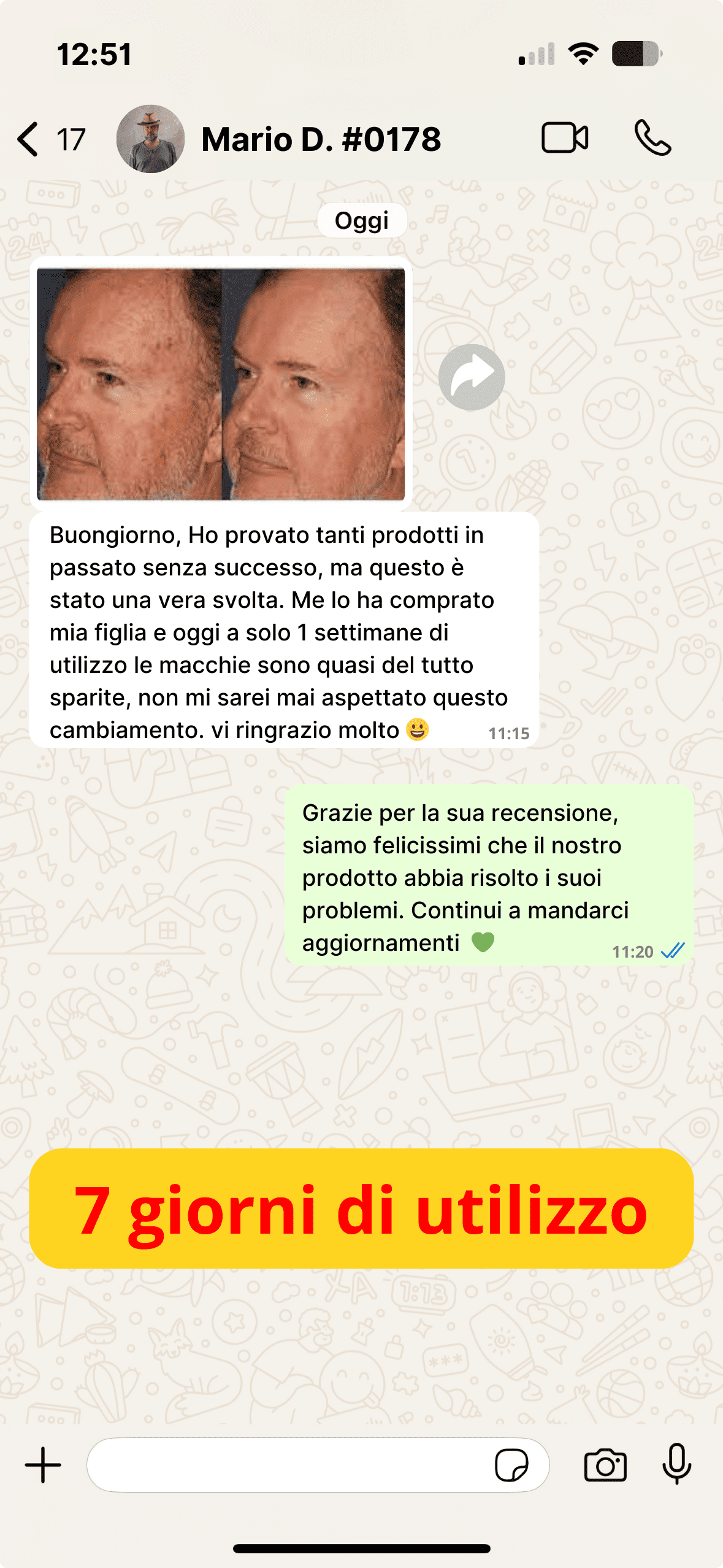 Antiage